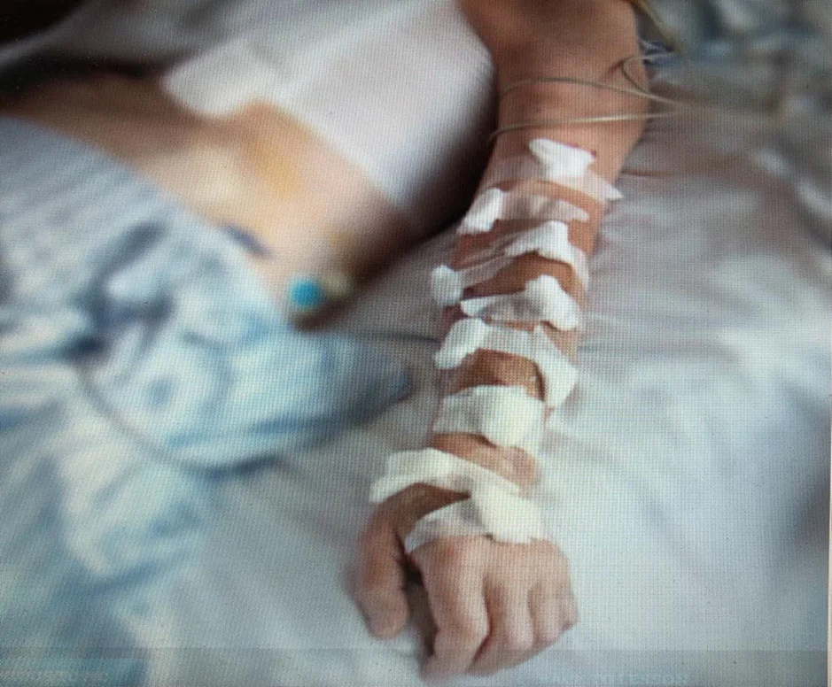 Mynd_til_presentation_av_DIVA patients in the Emergency og ultraljóð vegleiðing